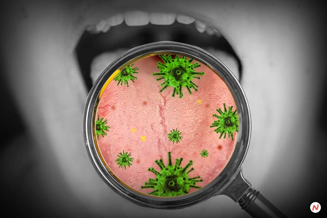 Study Finds Certain Mouth Bacteria Can Melt Head and Neck Cancers