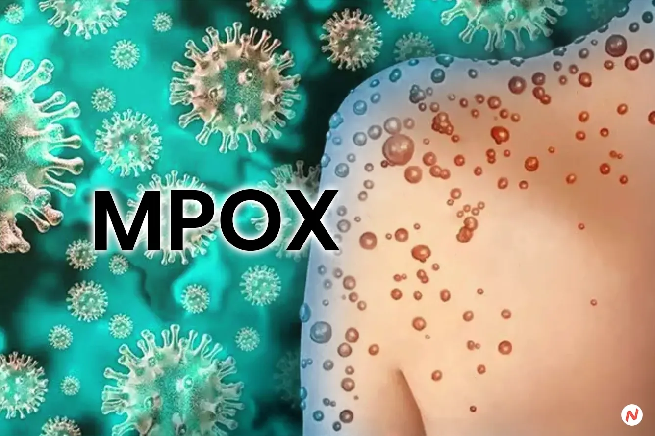 Africa Faces 160% Surge in Mpox Cases, WHO Considers Emergency Declaration