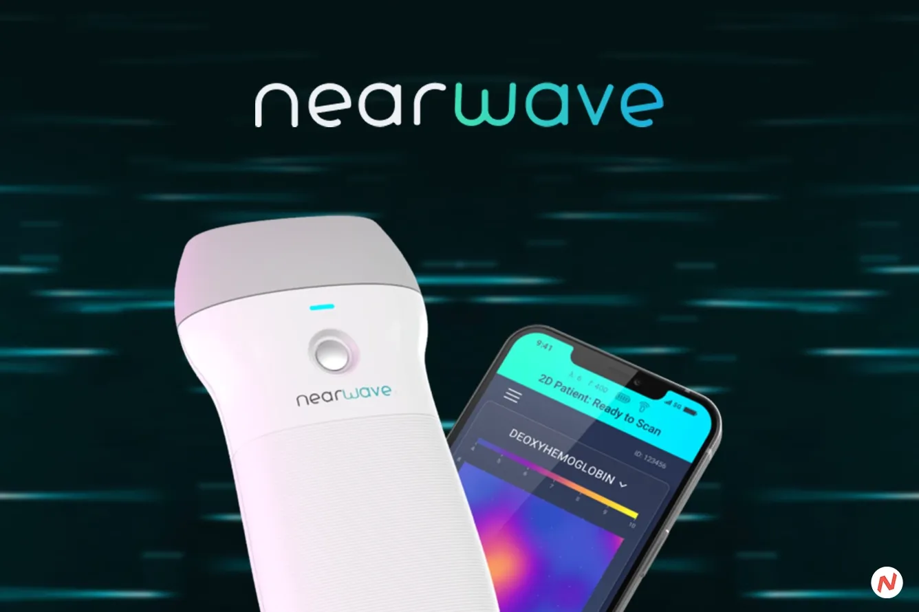 Advancements in Medical Imaging Technology at NearWave is Transforming MedTech